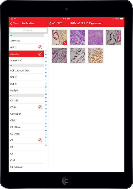 Leica Biosystems App Screen - 4 | Pathology & Diagnostic IHC Content Mobile App